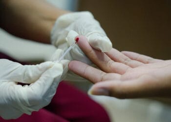 Serviço de Atendimento Especializado está disponível em Porto Velho