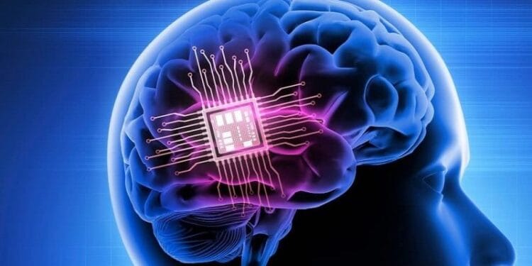 A introdução do implante cerebral da ‘Neuralink’, de Elon Musk, gera diferentes pontos de vista entre os especialistas; descubra o seu funcionamento