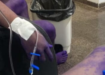 Calouros são hospitalizados após participarem de trote universitário em Rondônia