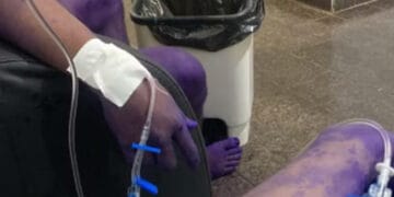 Calouros são hospitalizados após participarem de trote universitário em Rondônia