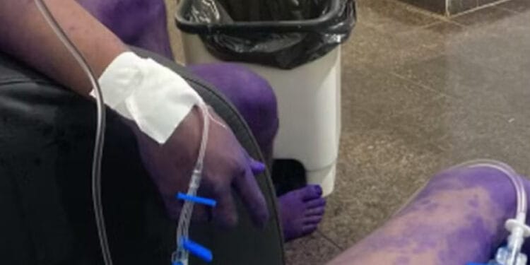 Calouros são hospitalizados após participarem de trote universitário em Rondônia