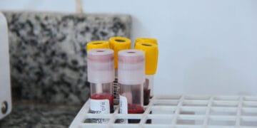 Governo de RO intensifica campanhas de doação de sangue para salvar vidas