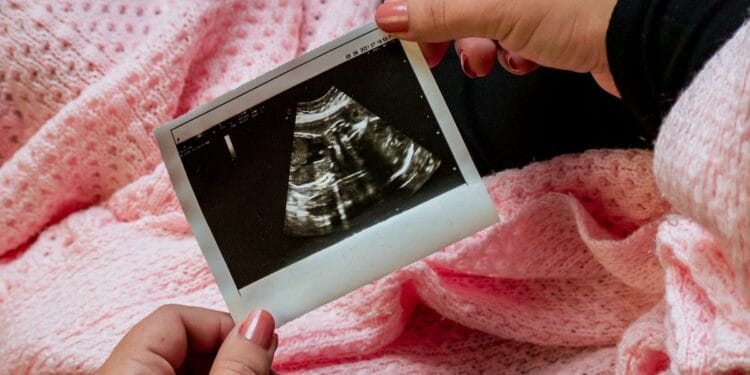 ‘Lei do Batimento Cardíaco’ salva 23.000 bebês do aborto, na Flórida