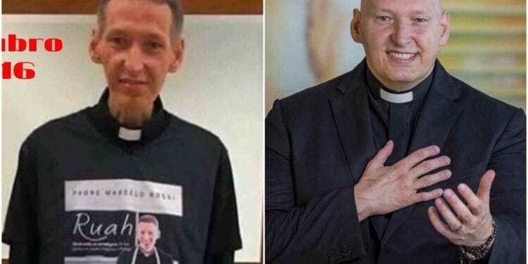 Padre Marcelo Rossi alerta sobre a depressão, mostrando imagens de antes e depois