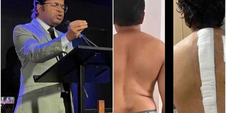 Veja o antes e o depois da cirurgia do pastor Nilson Gomes