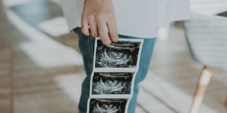 Escócia registra recorde histórico em números de abortos