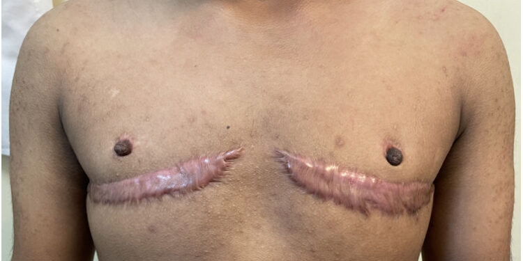 Trump encerra maior clínica de ‘mudança de sexo’ em jovens trans