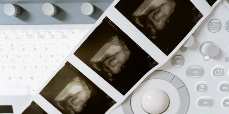 Irlanda registra quase 11 mil abortos e estabelece novo recorde em 2024