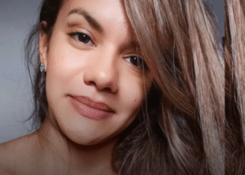 Mulher espancada com mais de 60 socos pelo namorado recebe alta após cirurgia de reconstrução facial