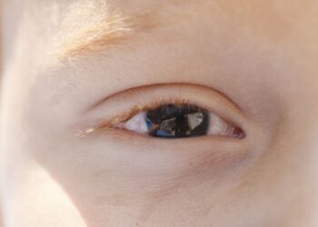 Cartilha sobre saúde ocular na infância orienta pais e professores