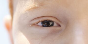 Cartilha sobre saúde ocular na infância orienta pais e professores