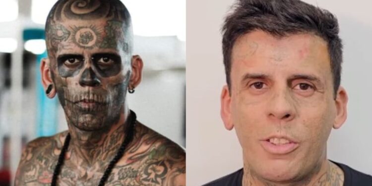 Homem mais tatuado do Brasil que se converteu remove tatuagens do rosto: “É sobre Jesus”