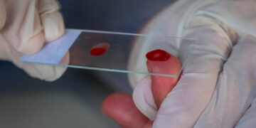 Diagnósticos e tratamentos para malária e hepatites virais são oferecidos pelo Centro de Pesquisa em Medicina de Rondônia