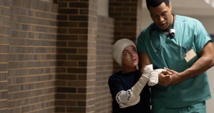 o caso do menino com corpo 100% queimado