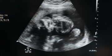 Contra aborto, Porto Rico passa a reconhecer feto como “pessoa natural” desde a concepção