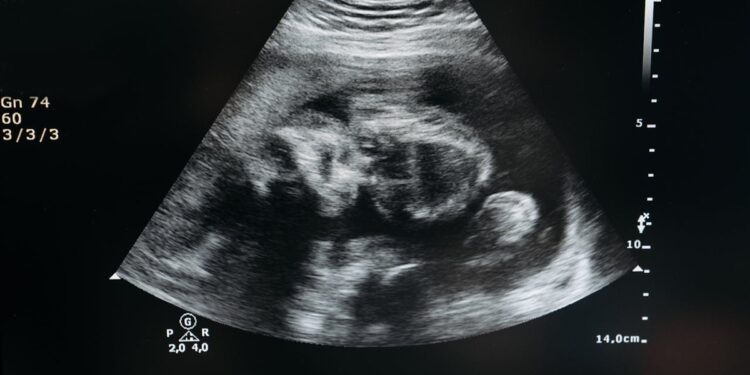 Contra aborto, Porto Rico passa a reconhecer feto como “pessoa natural” desde a concepção