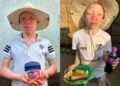 Missionários ajudam albinos perseguidos para rituais de feitiçaria