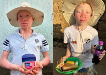 Missionários ajudam albinos perseguidos para rituais de feitiçaria