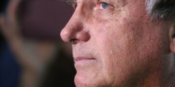 Após pedido de cirurgia, Moraes manda PF fazer perícia em Bolsonaro