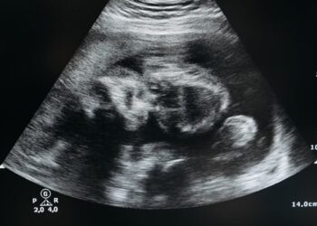 Contra aborto, Porto Rico passa a reconhecer feto como “pessoa natural” desde a concepção