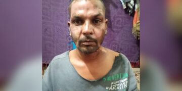 Muçulmano ateia fogo em cristão no Paquistão