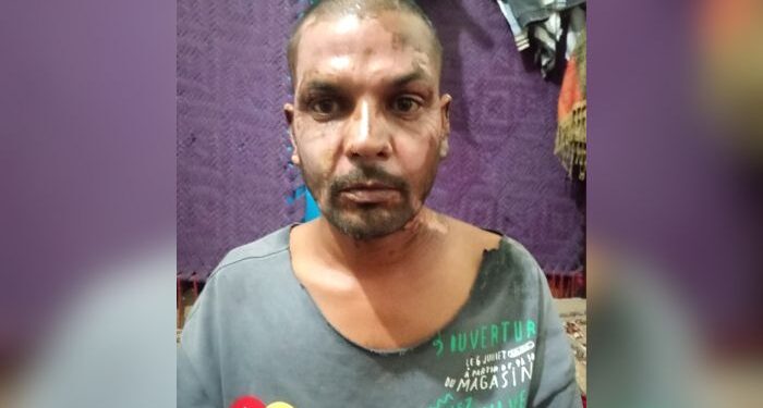 Muçulmano ateia fogo em cristão no Paquistão