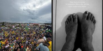 Nikolas Ferreira mostra pés machucados na caminhada a Brasília