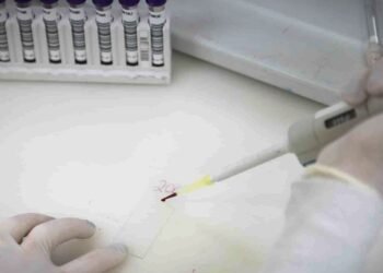 Paciente em SP com suspeita de ebola testa positivo para meningite