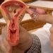 Aberta chamada pública para pesquisas sobre endometriose