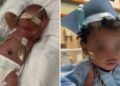Bebê prematuro recebe alta após nascer com apenas 24 semanas: “Um milagre”