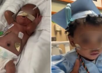 Bebê prematuro recebe alta após nascer com apenas 24 semanas: “Um milagre”