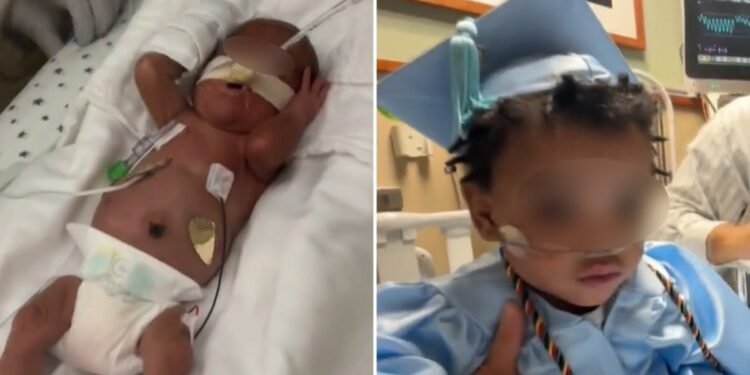 Bebê prematuro recebe alta após nascer com apenas 24 semanas: “Um milagre”