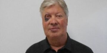 Robert Morris sofre queda e é hospitalizado com fraturas faciais