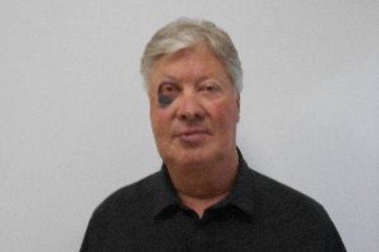 Robert Morris sofre queda e é hospitalizado com fraturas faciais