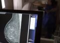 Entidades alertam médicos sobre pedidos de mamografia digital