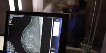 Entidades alertam médicos sobre pedidos de mamografia digital